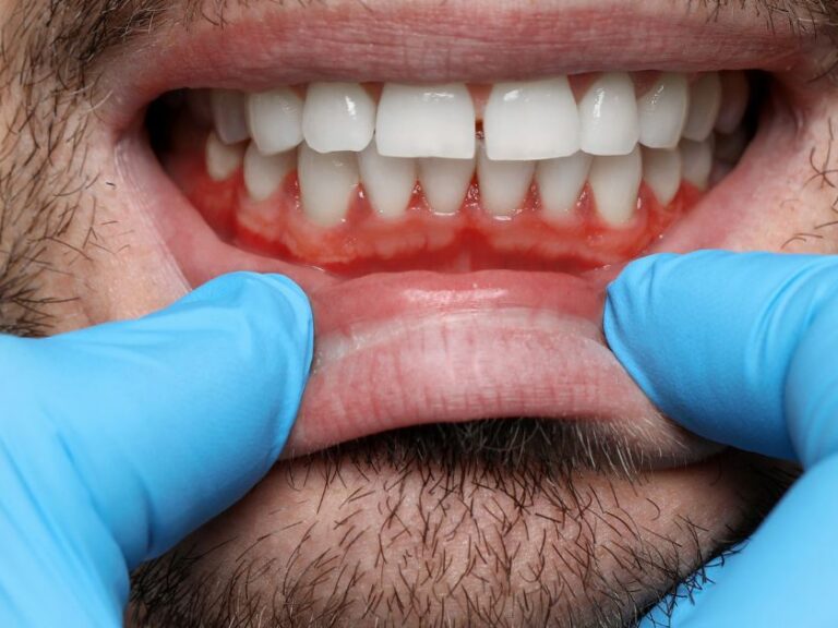 paradontologia dentista torino andrea bianco