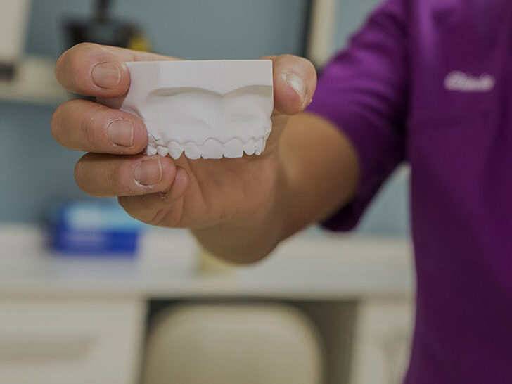 protesi dentale dentista bianco torino web 2